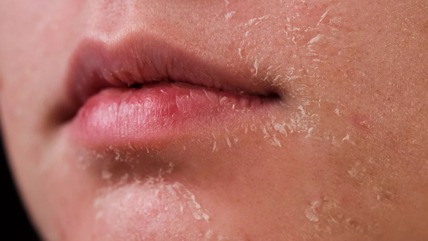 hydrotricks/will-dehydration-cause-headaches/3